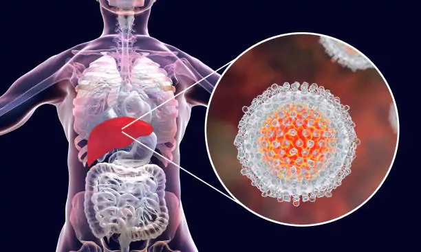 Viral Hepatitis